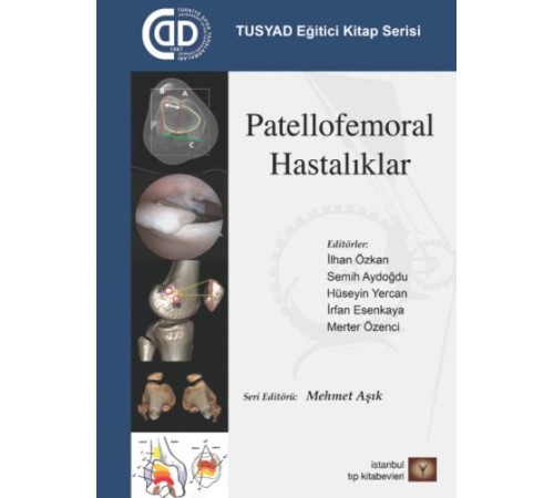 TUSYAD Eğitici Kitap Serisi - Patellofemoral Hastalıklar