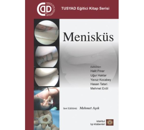 TUSYAD Eğitici Eğitim Seti - Menisküs